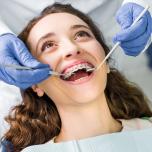 Dente che si muove cosa fare